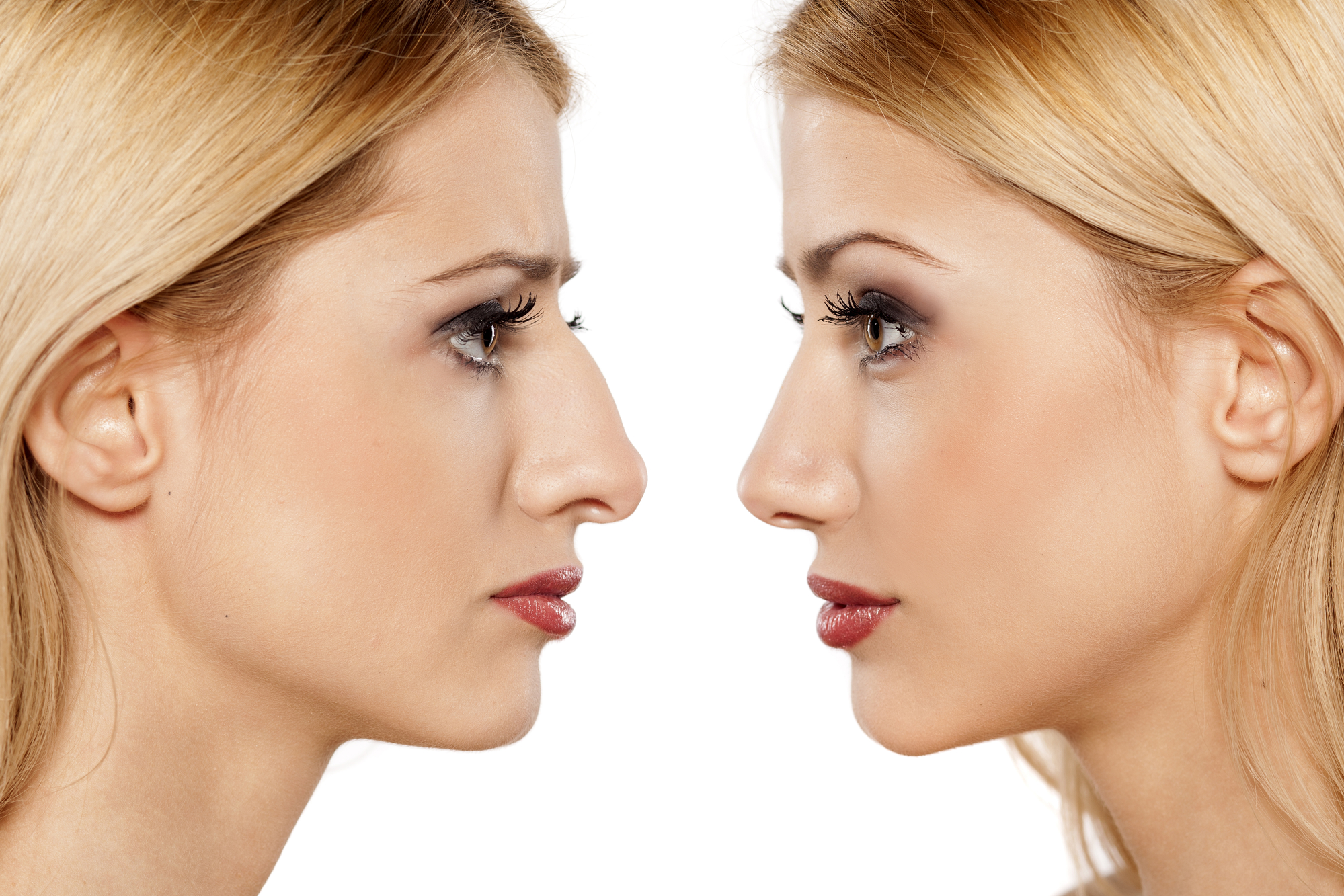 تجميل الأنف بالخيوط: كل ما تحتاج معرفته